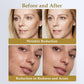 Red Light Therapy for Face, LED Face Mask Light Therapy, Portable Home Device with 7 Colors & 8 Modes, 850Nm near Infrared & Localized Blue Light Reduce Acne, 432 Beads Pro Leds
