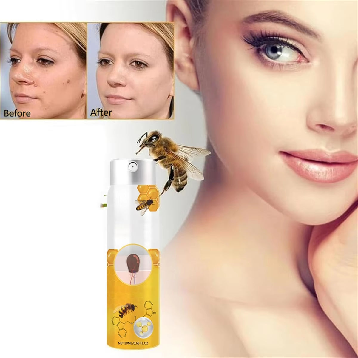 StingAway™ Bee Sting Remover Granules – Fast-Acting Relief for Men & Women, Easy and Effective